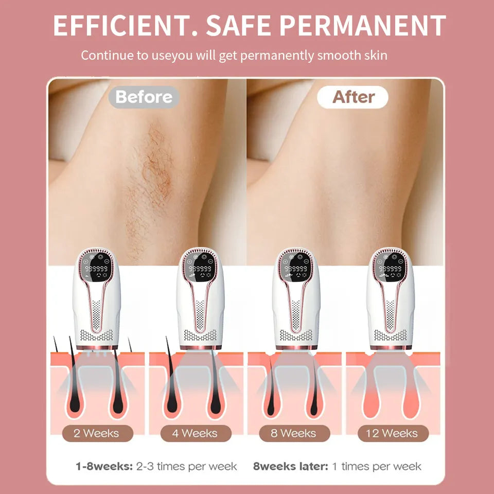 Top Angebot IPL Laser Haarentferner mit Gefrierfunktion Schmerzlos für zuhause  5 Stufige Stärke
